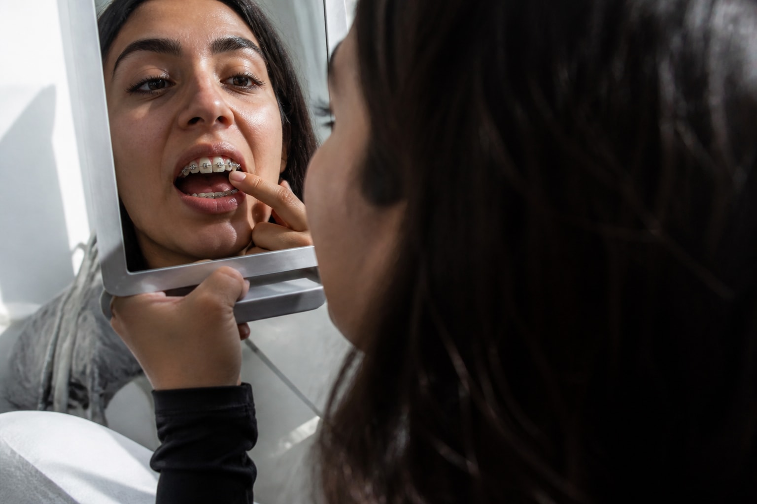 Brown Stains Around Braces: Is It the Tie or the Tooth?