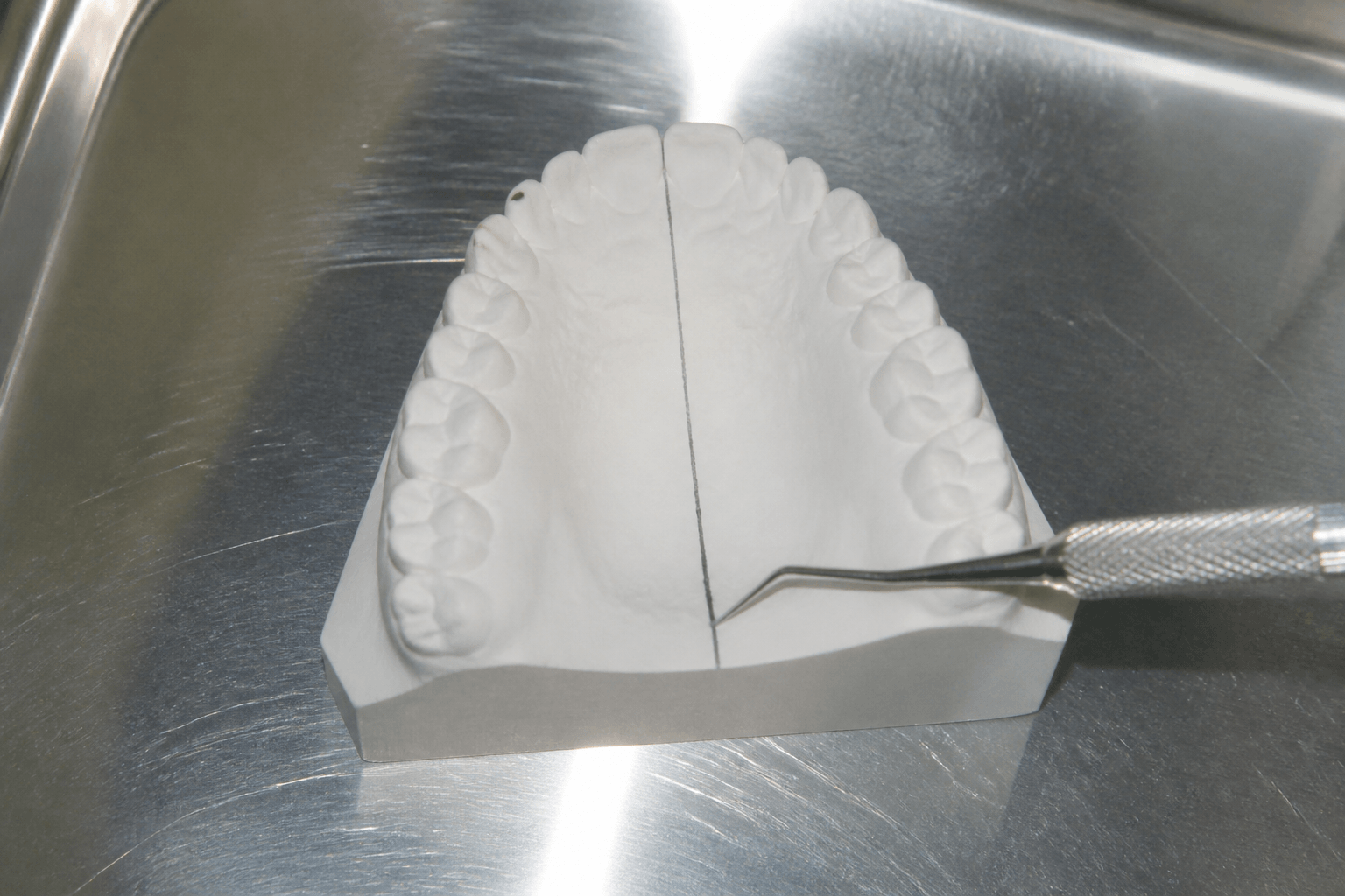 Dental Midline Off After Braces: What to Check