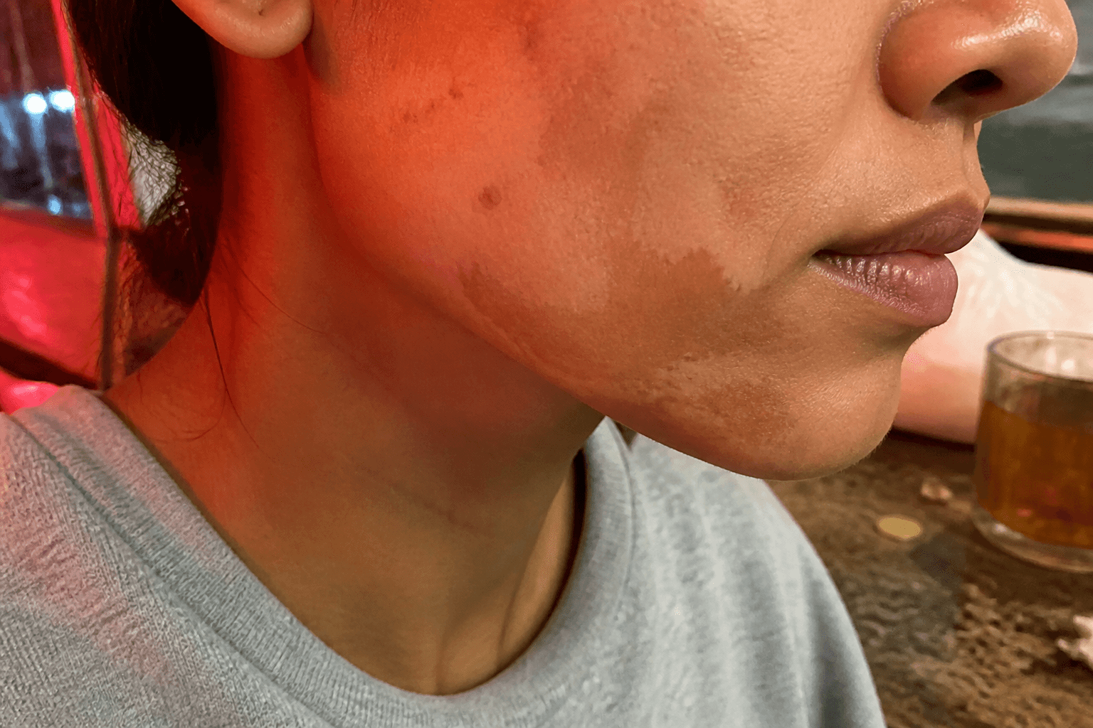 Why Does Self-Tanner Look Patchy on My Face?