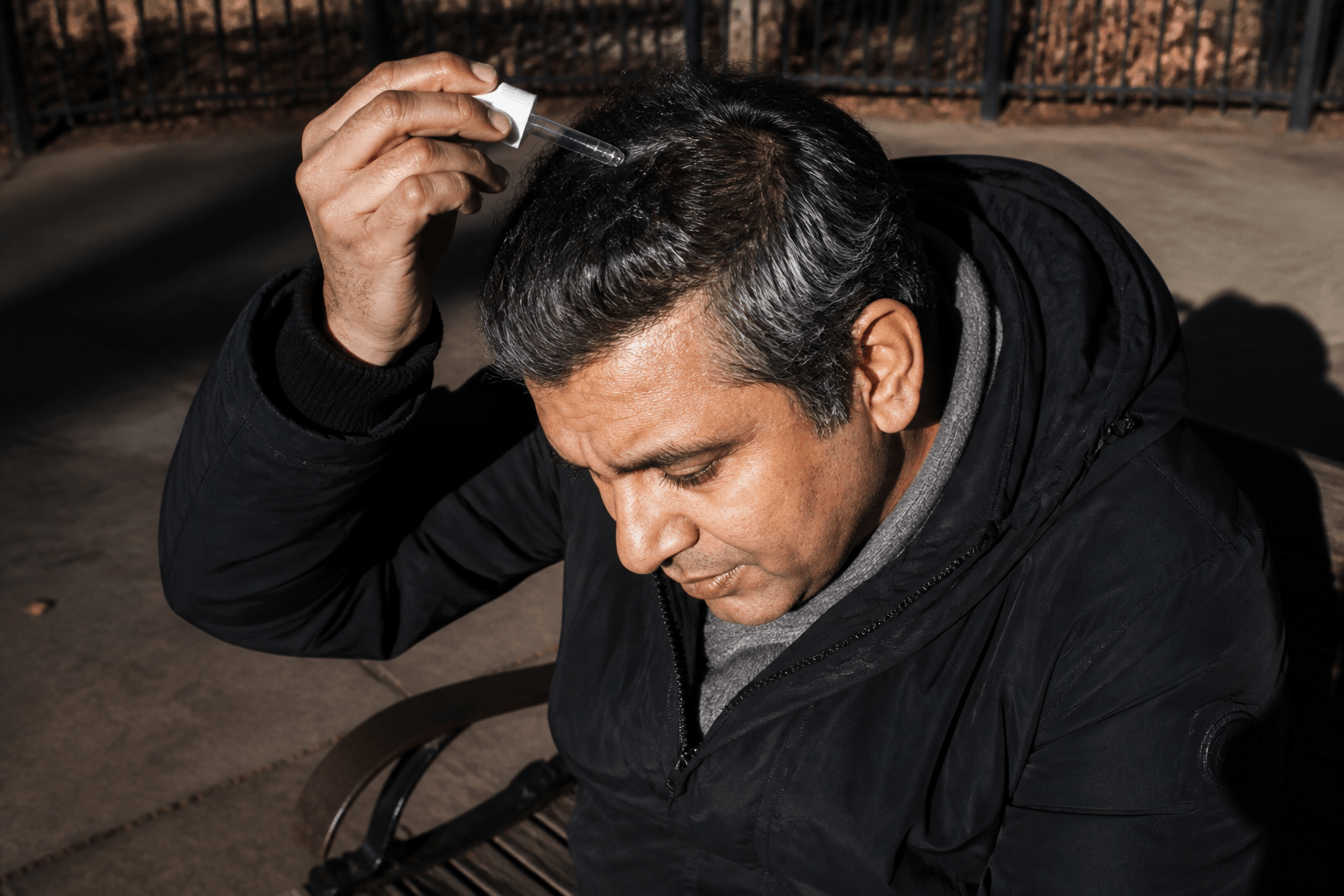 Why Does Minoxidil Make My Hair Greasy? What Helps