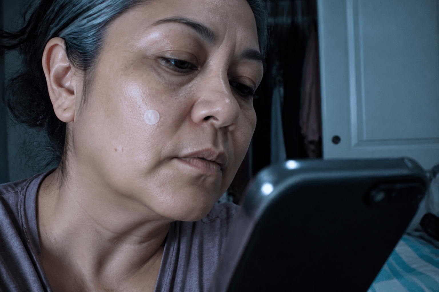 Why Does a Pimple Patch Turn White? What It Means