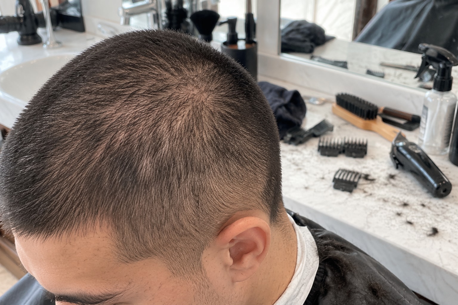 Buzz Cut Looks Patchy? Check These 5 Things First