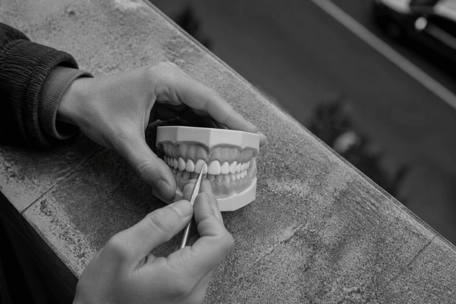 Why Does My Smile Show More Gum on One Side?