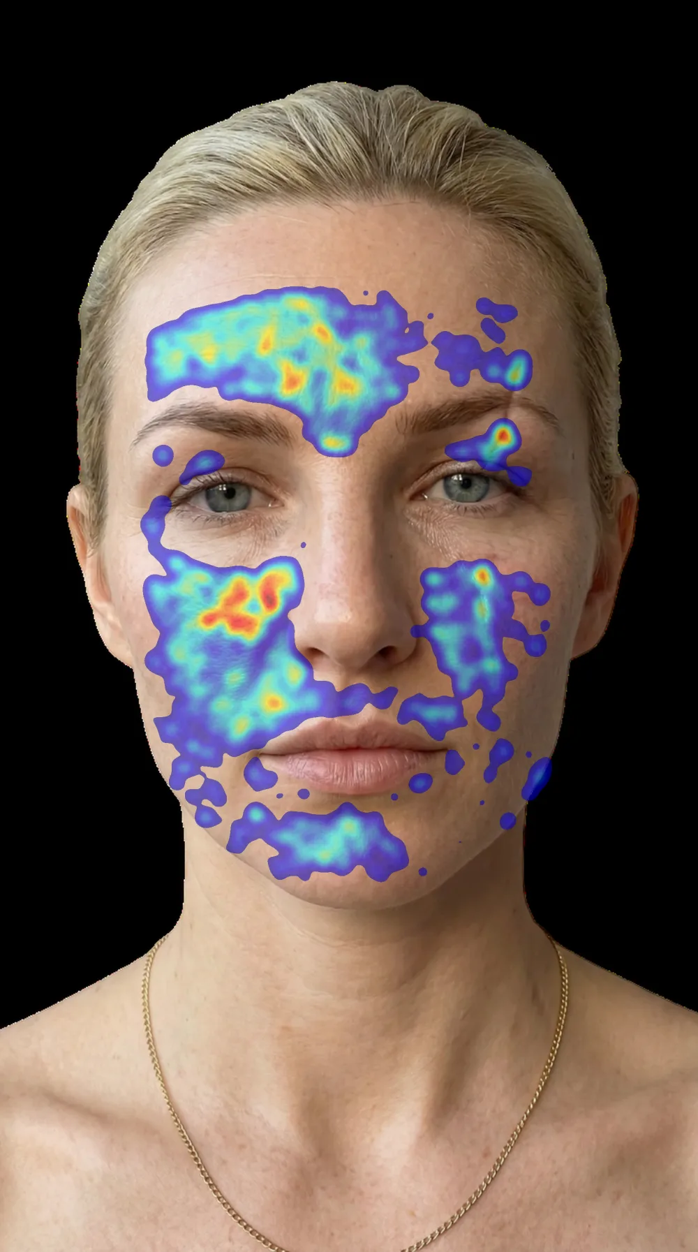 Thermal pore-density heatmap on the face